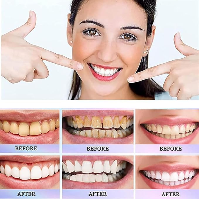 Nicotinamide Dazzling White Toothpastes