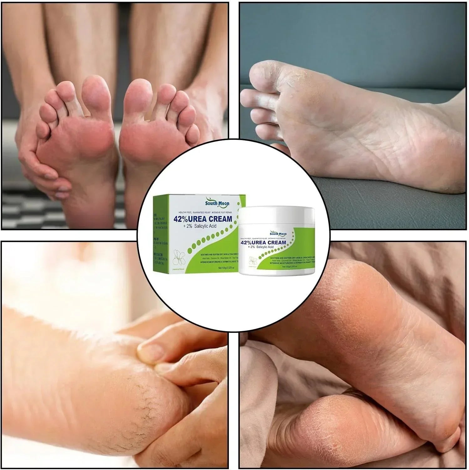 South Moon - 42% Urea Cream + 2% Salicylic Acid (Original) - Zaynah Mart