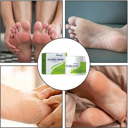 South Moon - 42% Urea Cream + 2% Salicylic Acid (Original) - Zaynah Mart